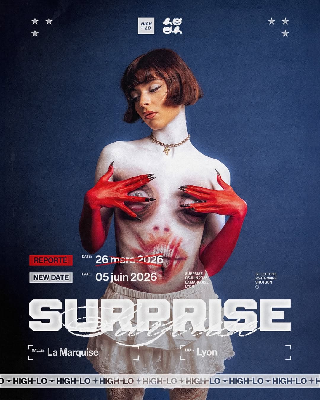 Surprise